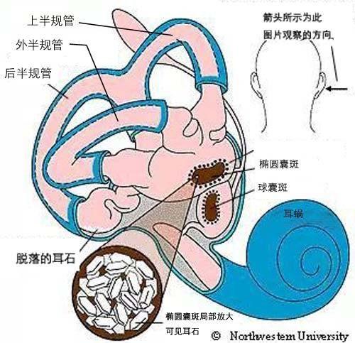 耳石症眩晕怎么办最快最有效视频,视频教程详解